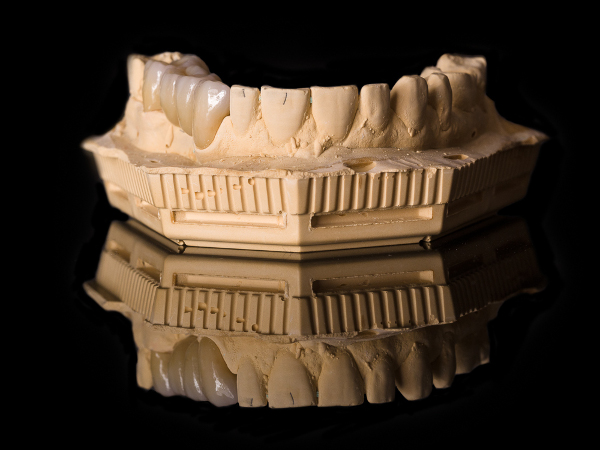 fija_zirconio_ceramica