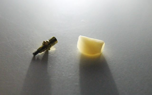 implante_zirconio_ceramica