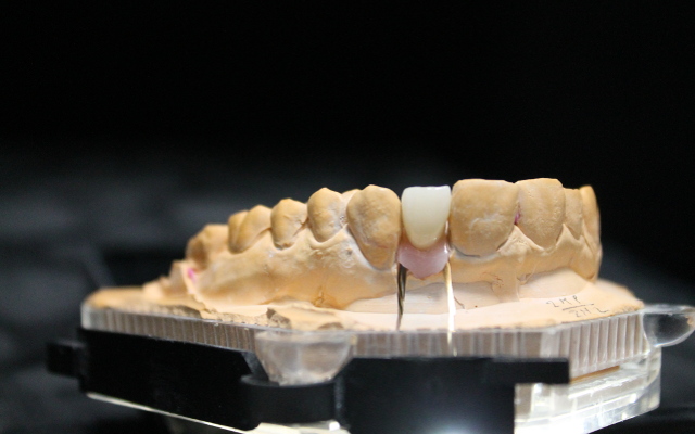 implante_zirconio_ceramica