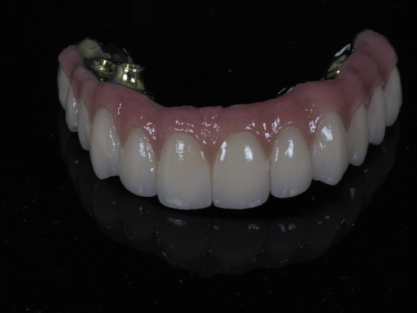 implante_blender