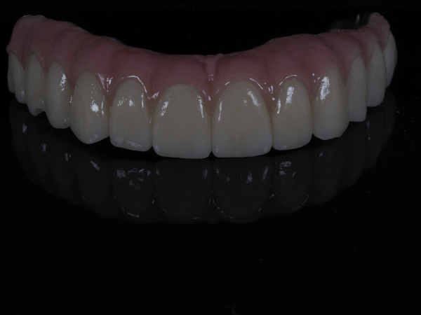 implante_blender