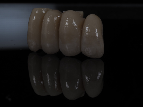 implante_zirconio_ceramica