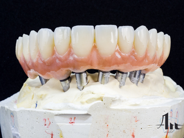 implante_zirconio_ceramica