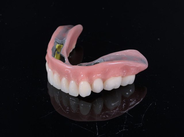 removible_sobre_dentadura