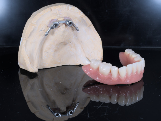 removible_sobre_dentadura