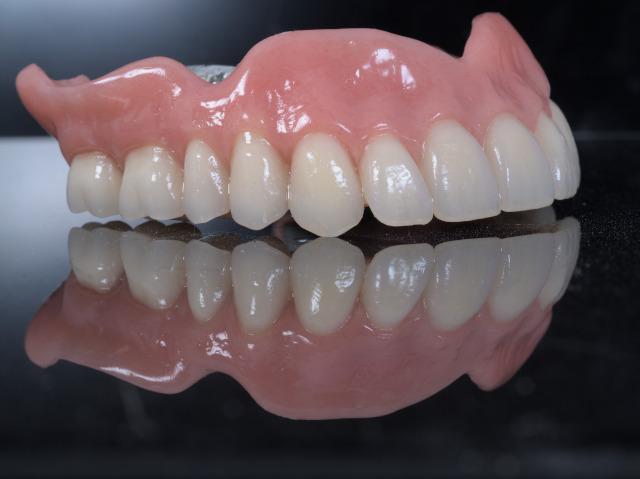removible_sobre_dentadura